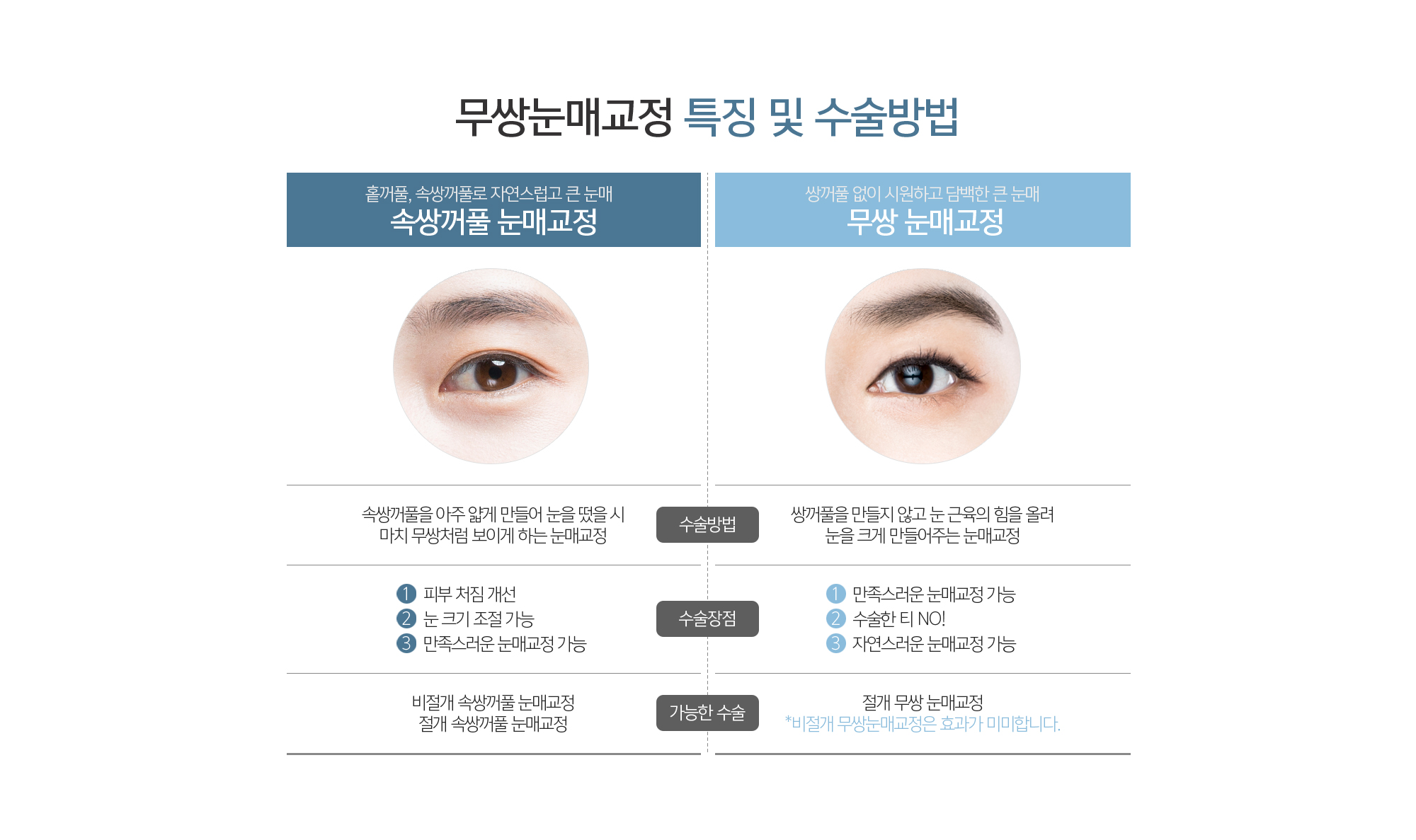 무쌍눈매교정 특징 및 수술방법